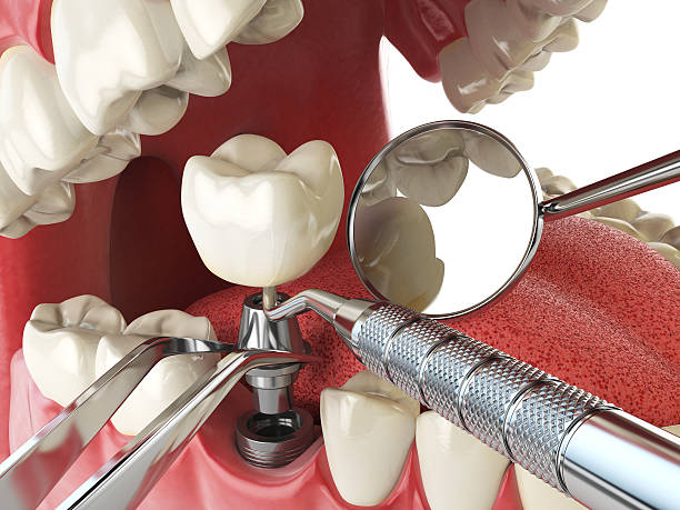 Best Emergency Dental Surgery in Jasper, TN